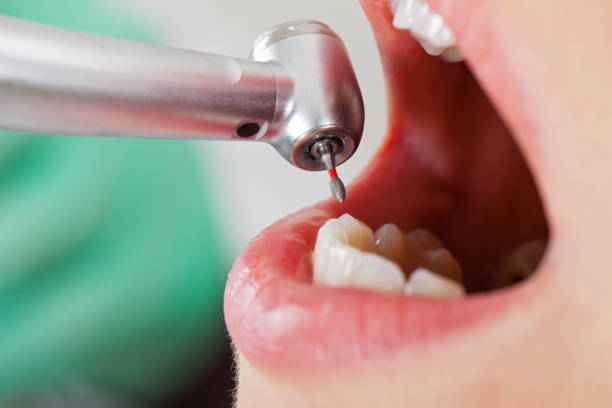Best Emergency Treatment for Toothache in North Bellport, NY